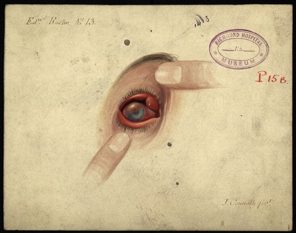 disease-of-the-eye-ucd-digital-library