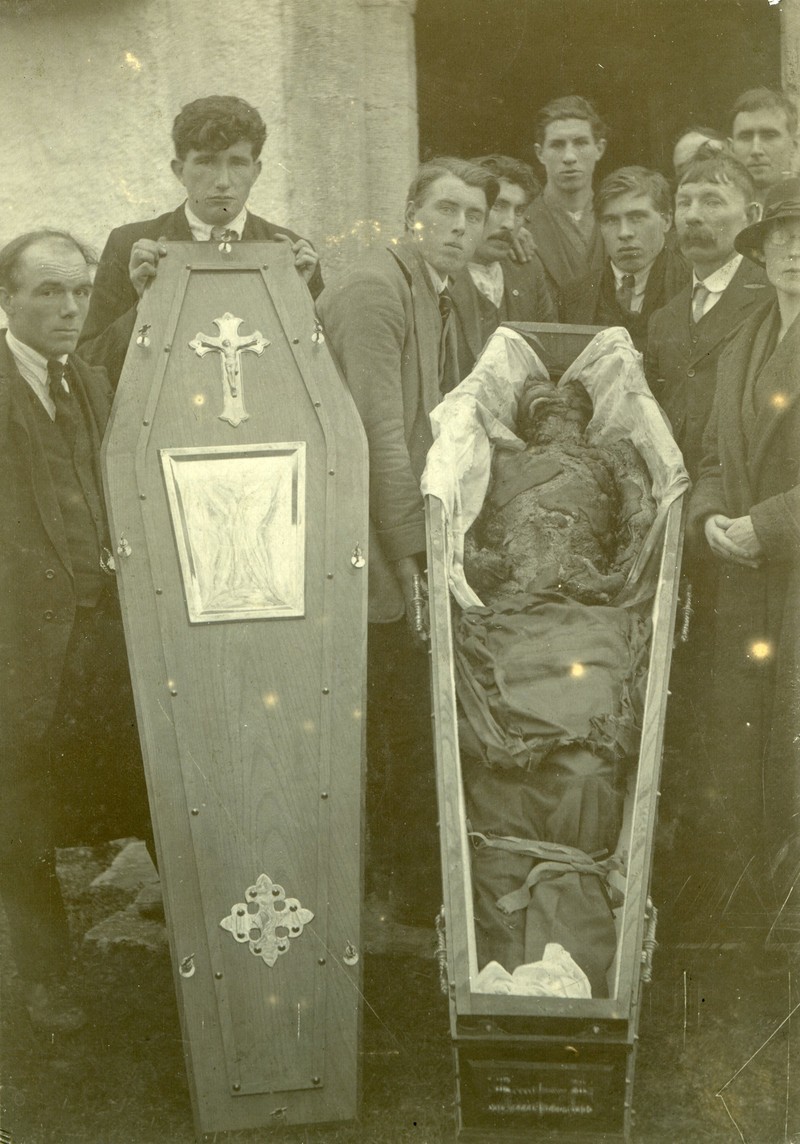 Badly Burned Body In A Coffin Ucd Digital Library